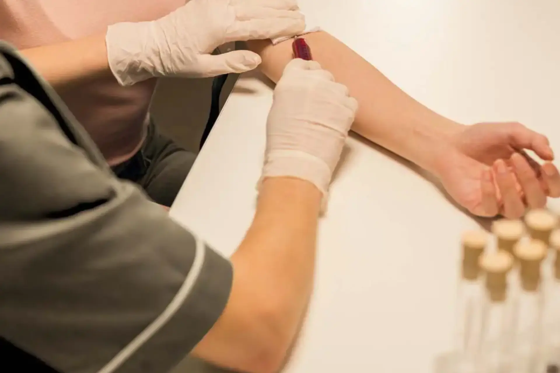 Choosing a Testosterone Clinic in Australia: What Men Should Know Before They Decide